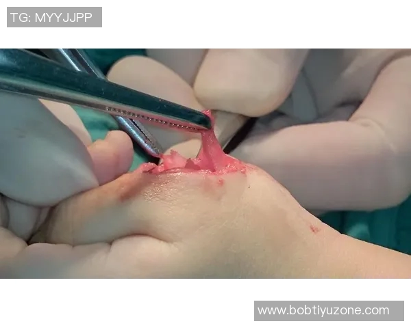 麦凯恩成功接受拇指韧带修复手术预计缺阵至少一个月 麦凯恩成功接受拇指韧带修复手术预计缺阵至少一个月